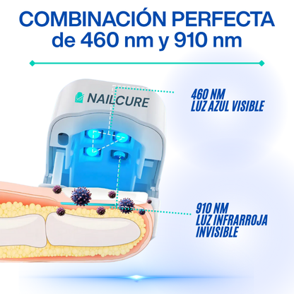 Tratamiento Láser Anti-hongos