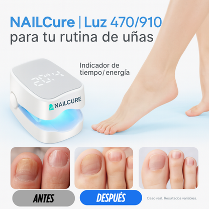 Tratamiento Láser Anti-hongos